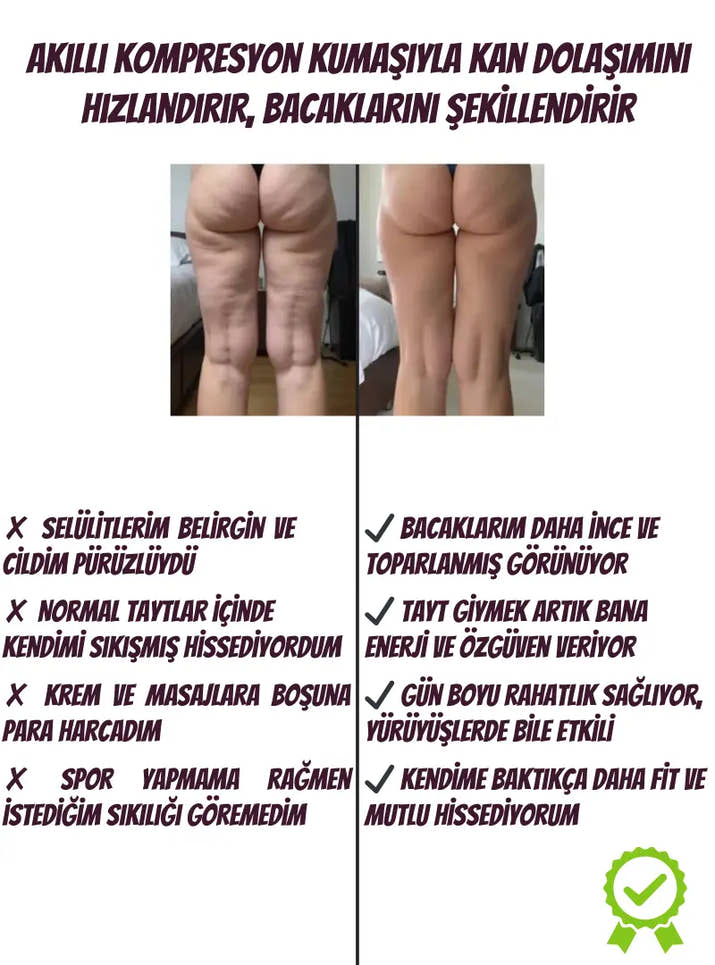 Stelluna Selülit Giderici Tayt