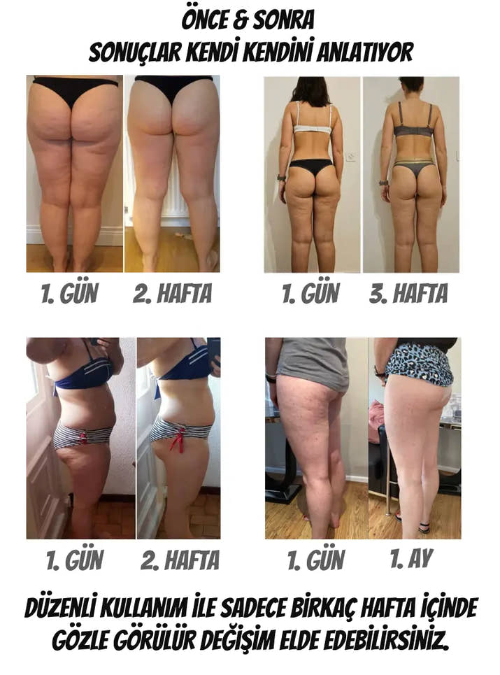 Stelluna Selülit Giderici Tayt